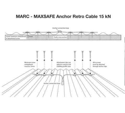 Cable Anchor - Multi Fit