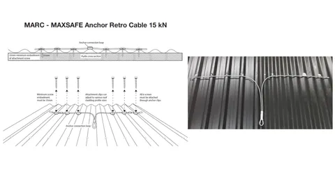 Cable Anchor - Multi Fit