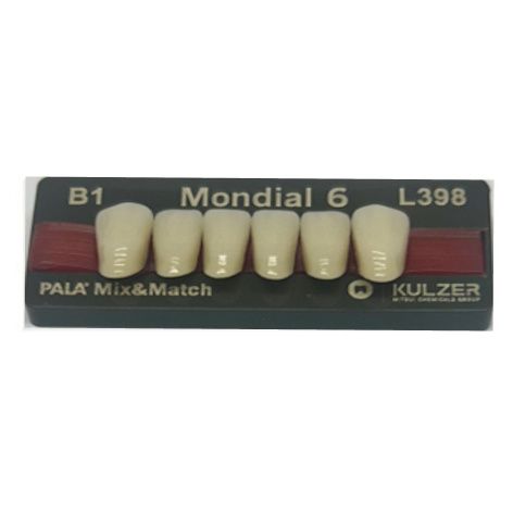 Mondial Shade B1 Anterior