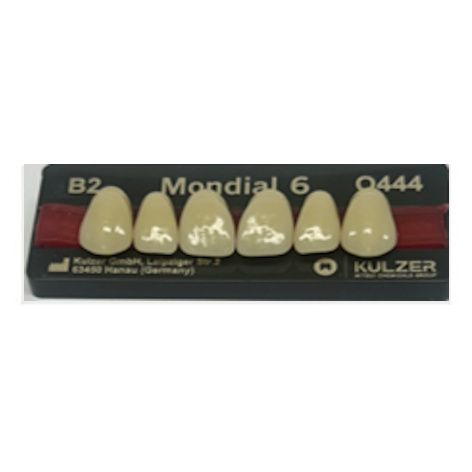 Mondial Shade B2 Anterior