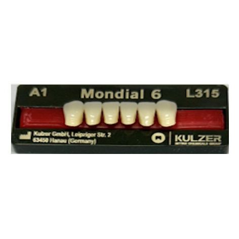 Mondial Shade A1 Anterior
