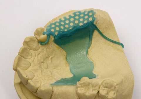 Renfert GEO Wax Rods