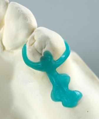 Premolar Clasps