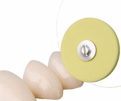 Cera Gloss HP Yellow Wheel Small