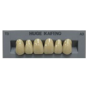 Anterior Kaifeng A3-T3