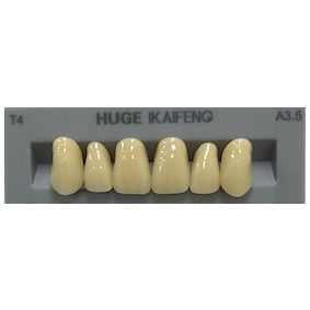 Anterior Kaifeng A3.5-T4