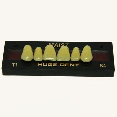 Anterior Maist B4-T1