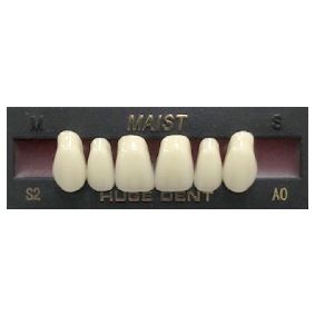 Anterior A0-S2 Bleach Shade