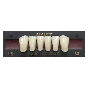 Anterior A0-L6 Bleach Shade