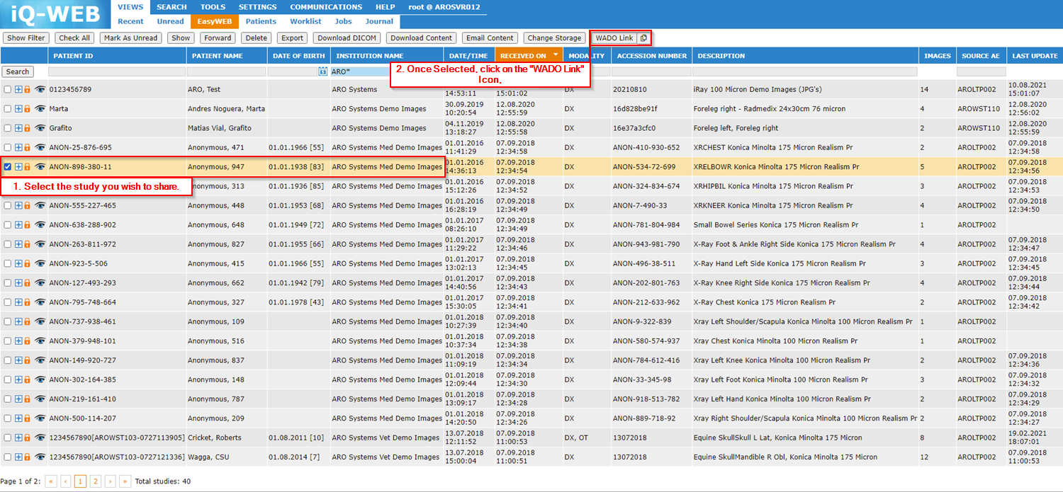 Share Study in ARO PACS