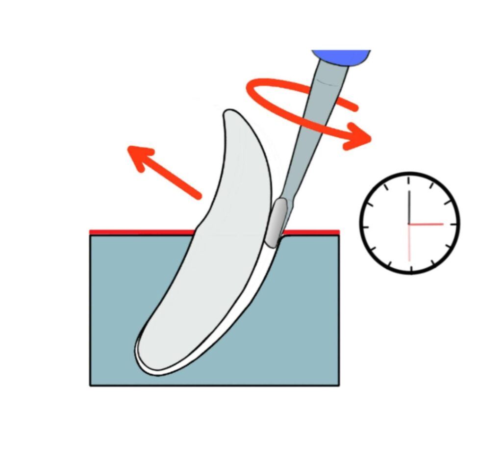 Dentanomic elevation