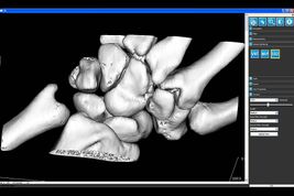 IQ-3D 3D x-ray model 2