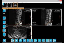 IQ-VIEW study screenshot of spines