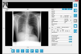 IQ-VIEW import study