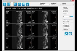 Screenshot of multiple x-rays in IQ-View