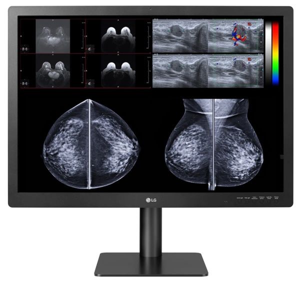 LG 31HN713D Medical Mammography Multimodality Diganostic Reporting Monitor with mammograpy images on it