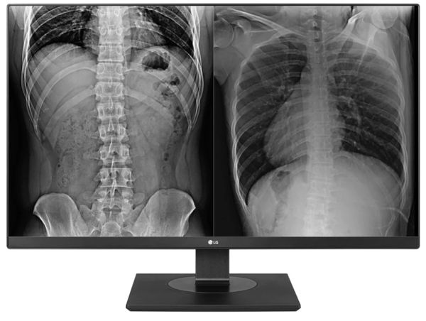LG 27HK713C-B Medical Clinical Review Monitor with x-rays on it