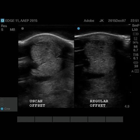 Podoblock U-Scan