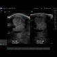 Podoblock U-Scan
