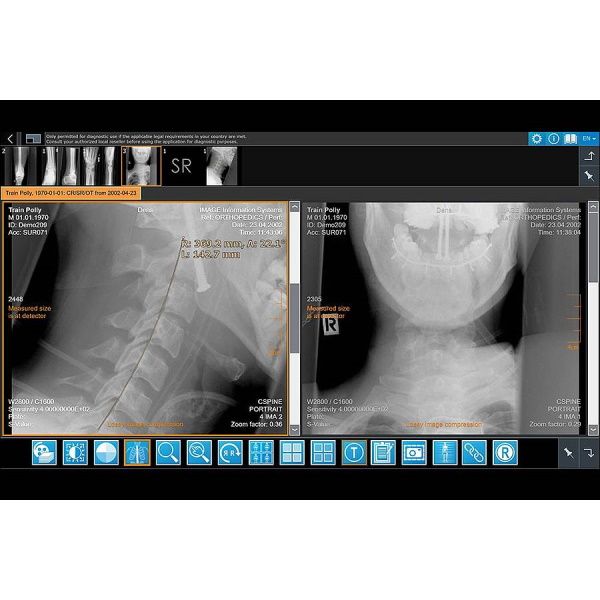 iQ-4VIEW Zero Footprint Viewer: iQ-WEB Plugin