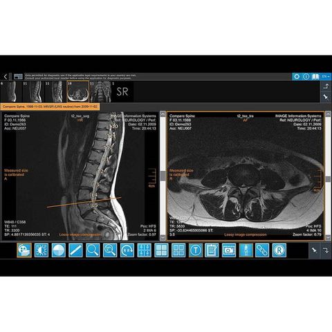 iQ-4VIEW Zero Footprint Viewer: iQ-WEB Plugin