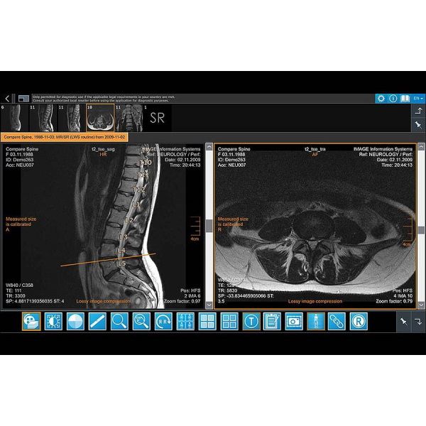 iQ-4VIEW Zero Footprint Viewer: iQ-WEB Plugin