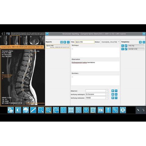 iQ-4VIEW Zero Footprint Viewer: iQ-WEB Plugin