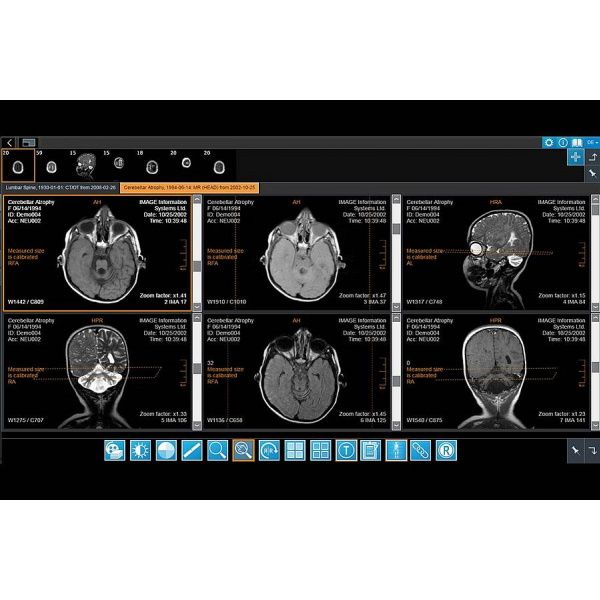 iQ-4VIEW Zero Footprint Viewer: iQ-WEB Plugin