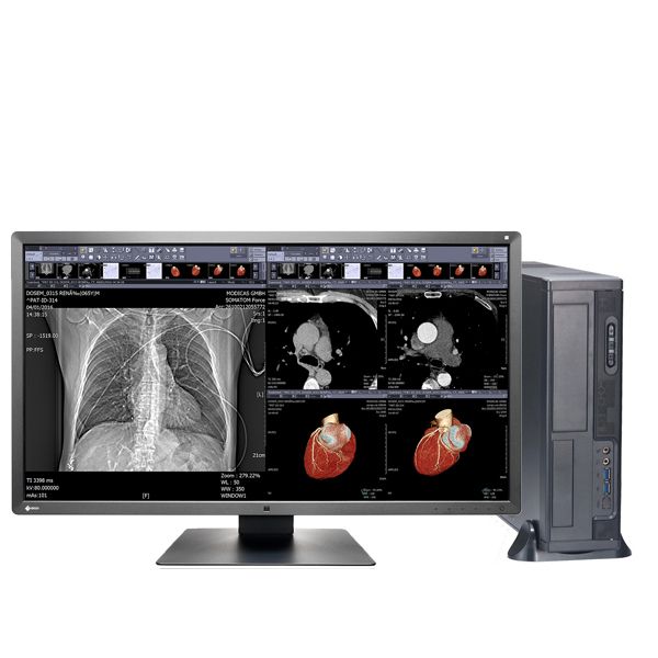 Medical Eizo Radiforce MX315W & SS21 Home Reporting Bundle