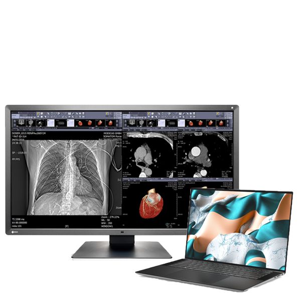 Medical Eizo Radiforce MX315W & XPS 15 Home Reporting Bundle