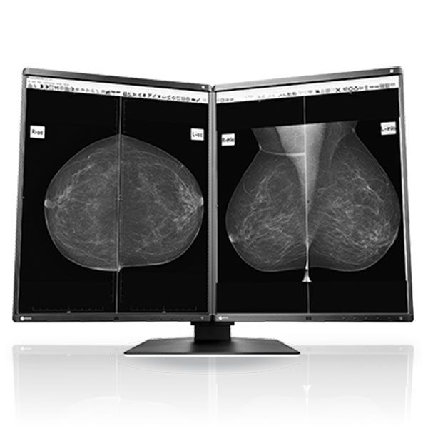 Eizo Radiforce GX560 21.3" 5MP Monochrome LCD Monitor