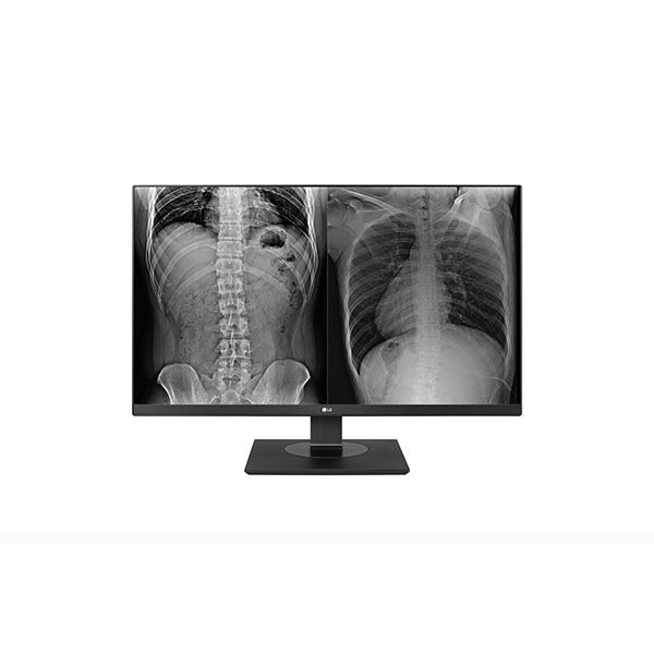 LG 27" 8MP Clinical Review Monitor