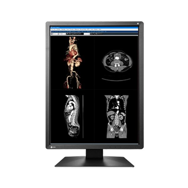 Eizo Radiforce MX216 2MP 54cm (21.3") Colour LCD Monitor