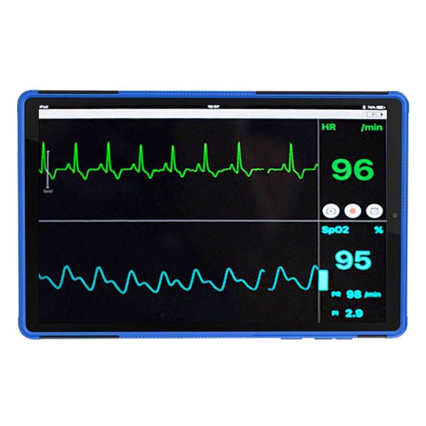 Sentier Vetcorder™ Classic Portable Patient Monitor with 8" Tablet