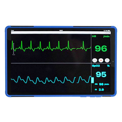 Sentier Vetcorder™ Classic Portable Patient Monitor with Reflectance Sensor and 8" Tablet