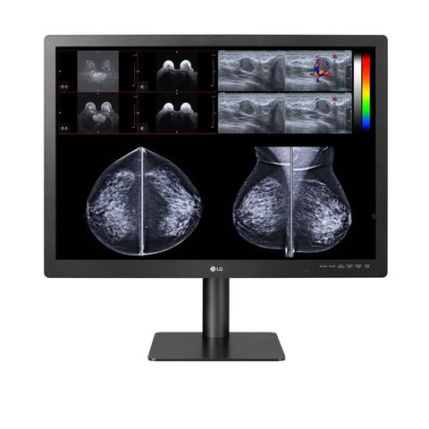 LG 31'' 12MP Diagnostic Review Monitor for Mammography