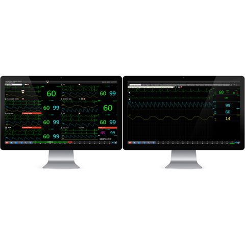 BMV BMO-210 Central Monitoring System Software for up to 16 Units on USB