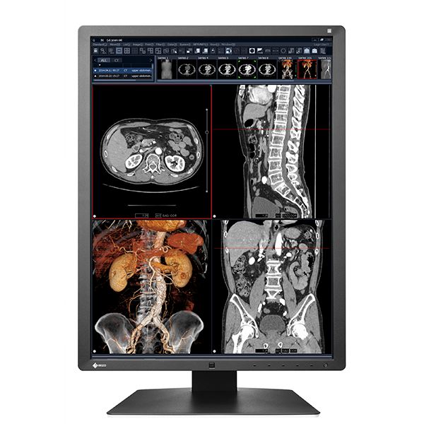 Eizo Radiforce RX270 21.3" 2MP Color LCD Monitor