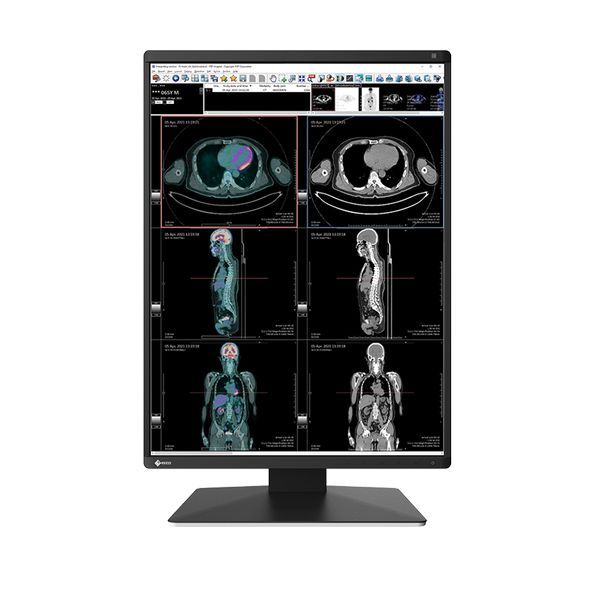 Eizo Radiforce RX370 21" 3MP LED Medical Colour Monitor