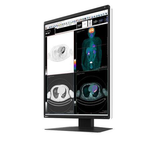 Eizo Radiforce RX370 21" 3MP LED Medical Colour Monitor