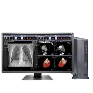 Workstation & Teleradiology Solutions