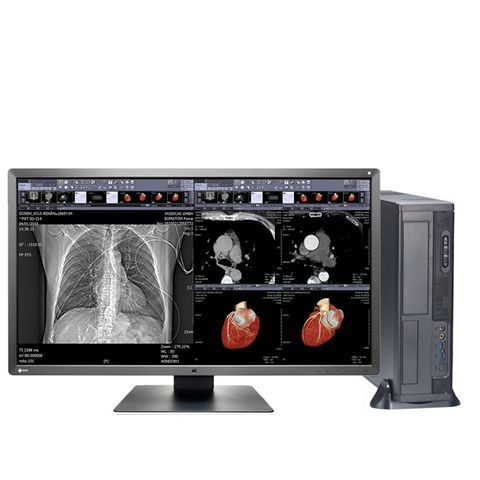 ARO System Teleradiology Worksation | PRO