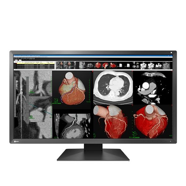 Eizo RadiForce MX317W 30.5" 8MP LED Clinical Review