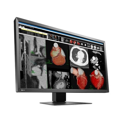 Eizo RadiForce MX317W 30.5" 8MP LED Clinical Review
