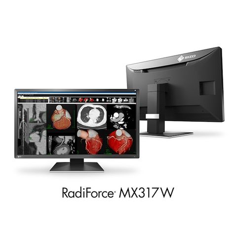 Eizo RadiForce MX317W 30.5" 8MP LED Clinical Review