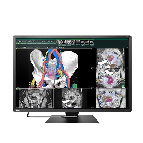 Eizo RadiForce RX670 31" 6MP LED Medical Colour Monitor