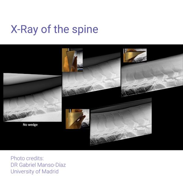 Podoblock Aluminium Wedge
