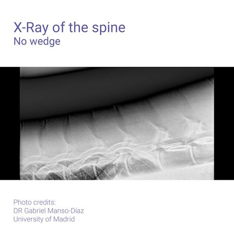 Podoblock Aluminium Wedge