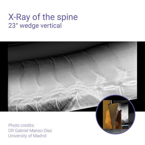 Podoblock Aluminium Wedge