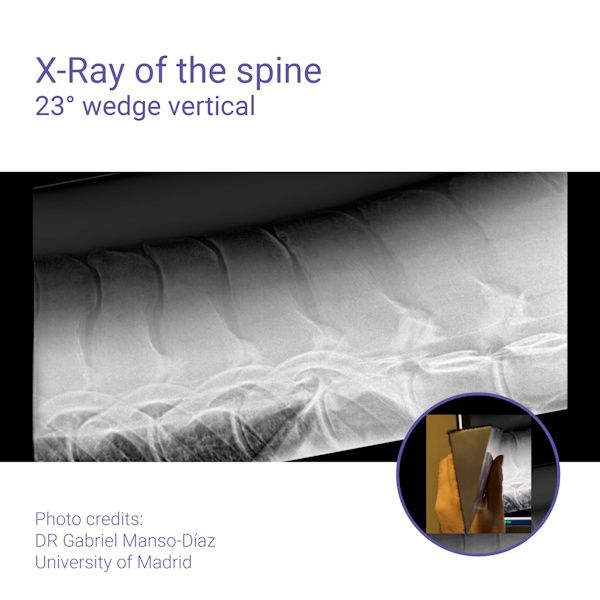 Podoblock Aluminium Wedge